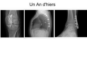 Un-An-d-hiers-quidelombre